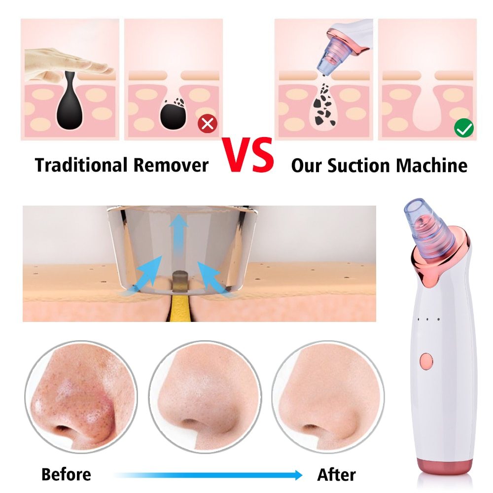 Acne Cleaning Facial Electric Blackhead Suction Tool